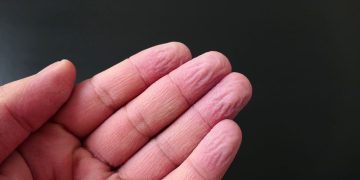 Por que os dedos enrugam na água? Descubra agora