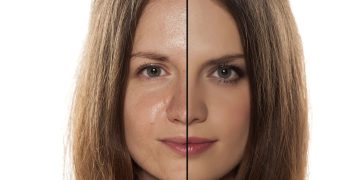 Sua pele é oleosa? Entenda e cuide dela corretamente