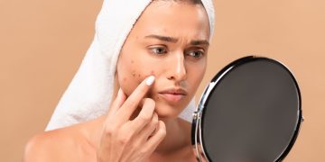 A espironolactona pode tratar acne e queda capilar? Veja a seguir