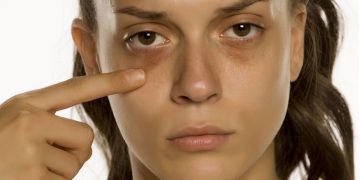 Dicas para tratar olheiras - confira a seguir