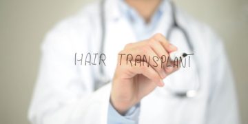 Pós-transplante capilar: como garantir os melhores resultados?